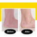 Аккумуляторная пемза для пяток Remove Calluses, машинка для удаления мозолей, пилки для ног